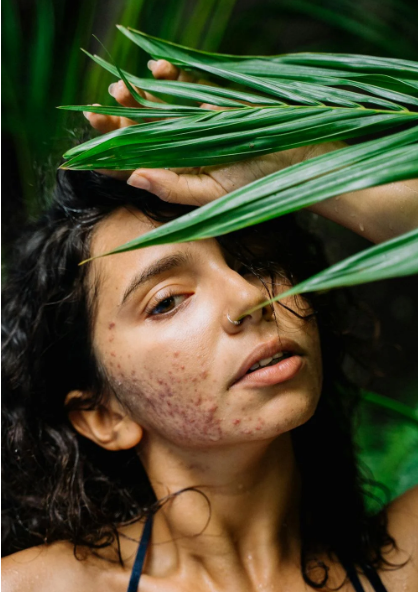 Fresh & Dewy: Water-Based Serums to Keep Skin Calm in Humidity